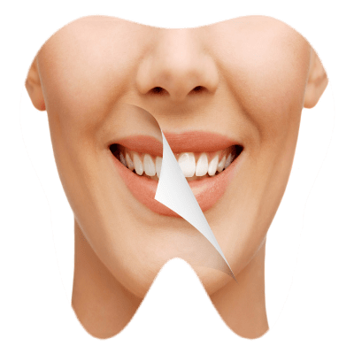 Best Smile designing